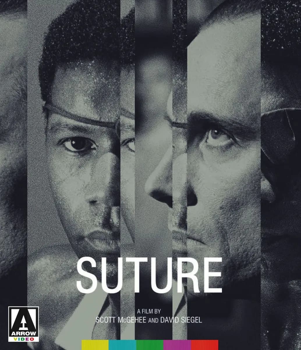 Suture cover